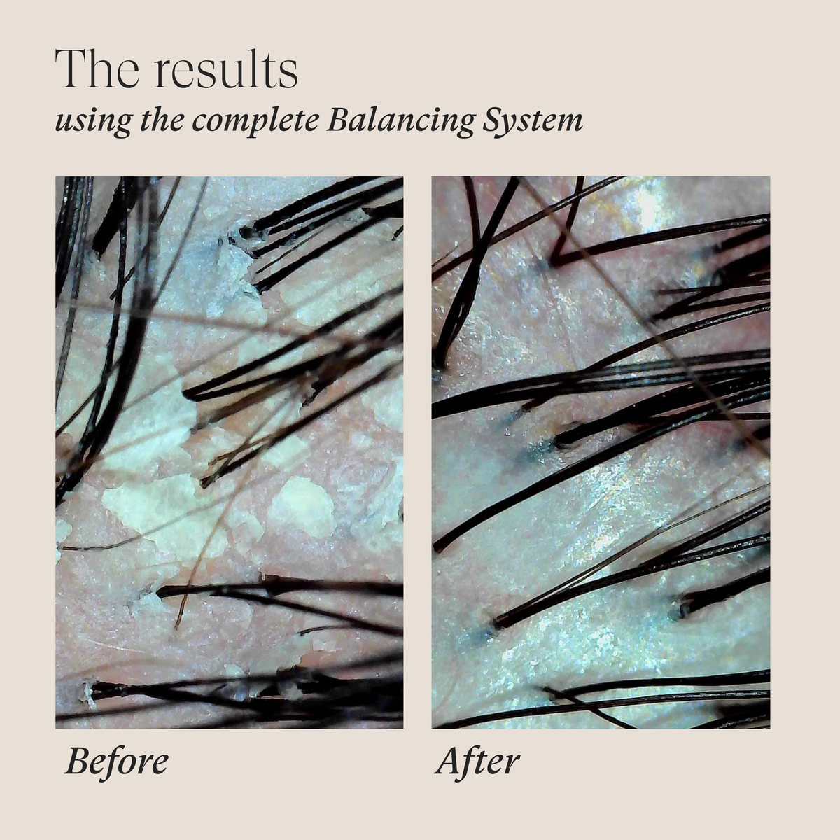 Scalp Therapy Balancing System Holiday Trio
