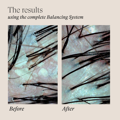 Scalp Therapy Balancing System Holiday Trio